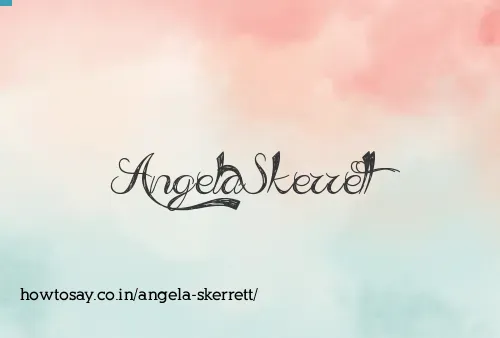Angela Skerrett