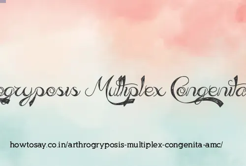 Arthrogryposis Multiplex Congenita Amc