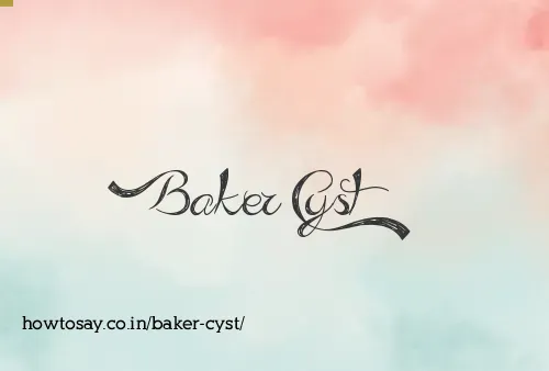 Baker Cyst