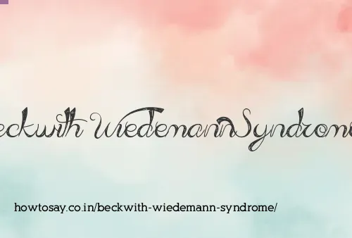 Beckwith Wiedemann Syndrome