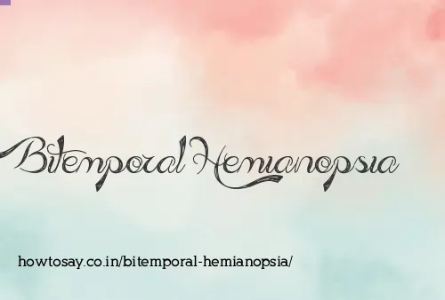 Bitemporal Hemianopsia