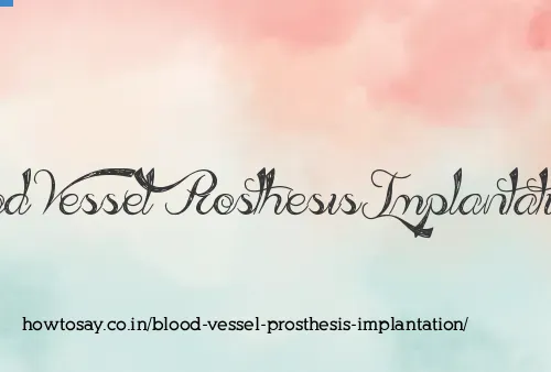 Blood Vessel Prosthesis Implantation