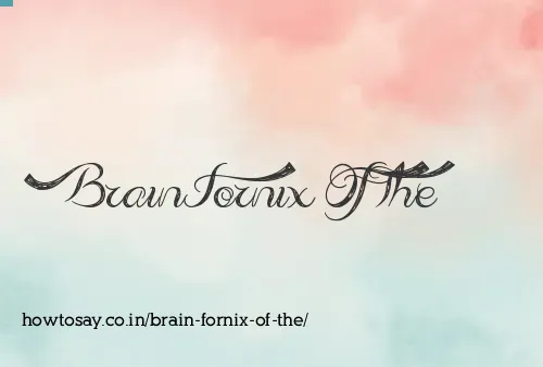 Brain Fornix Of The