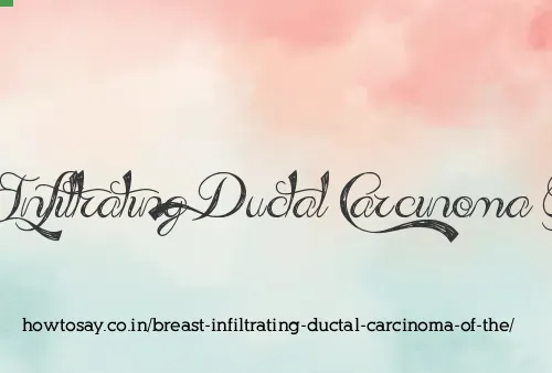 Breast Infiltrating Ductal Carcinoma Of The