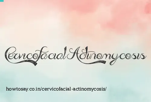 Cervicofacial Actinomycosis