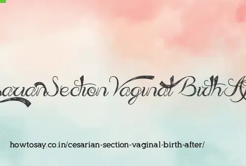 Cesarian Section Vaginal Birth After