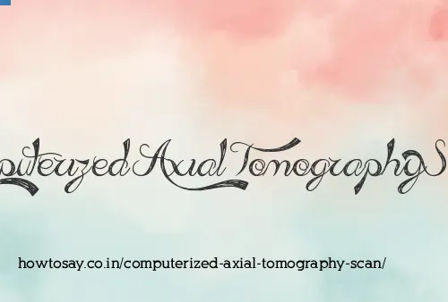 Computerized Axial Tomography Scan