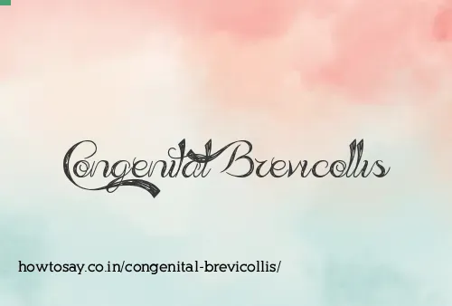 Congenital Brevicollis