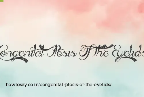 Congenital Ptosis Of The Eyelids