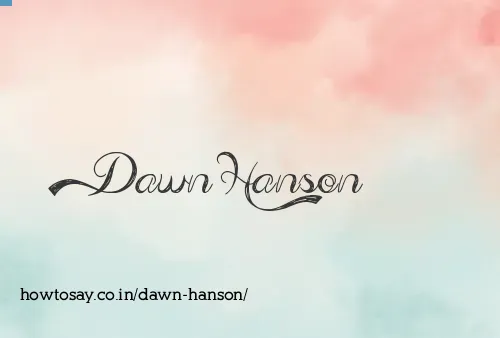 Dawn Hanson