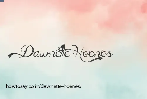 Dawnette Hoenes