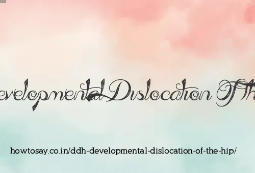 Ddh Developmental Dislocation Of The Hip