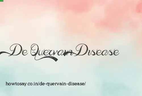 De Quervain Disease