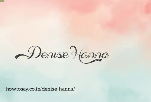 Denise Hanna