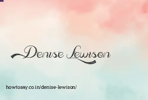 Denise Lewison