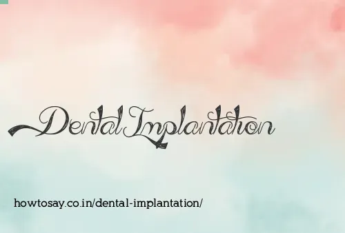 Dental Implantation