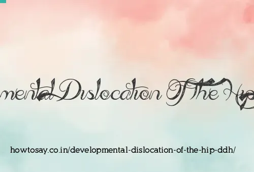 Developmental Dislocation Of The Hip Ddh
