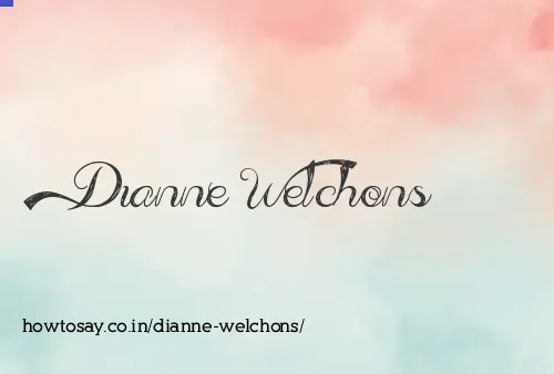 Dianne Welchons