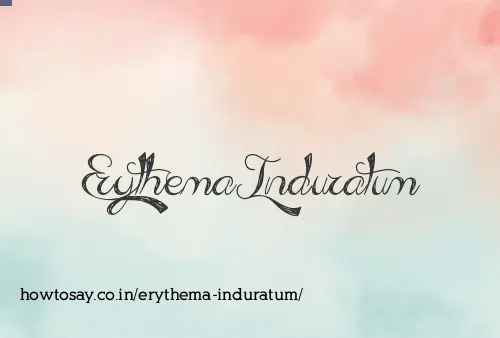 Erythema Induratum