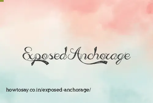 Exposed Anchorage
