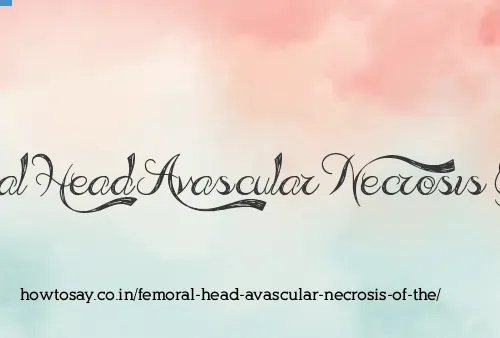Femoral Head Avascular Necrosis Of The