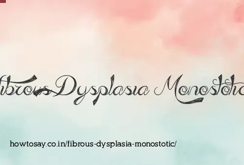 Fibrous Dysplasia Monostotic