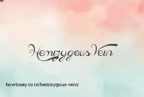Hemizygous Vein