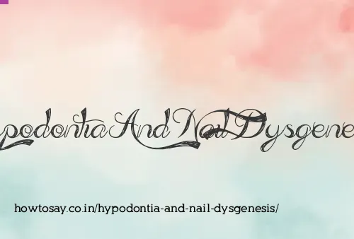 Hypodontia And Nail Dysgenesis