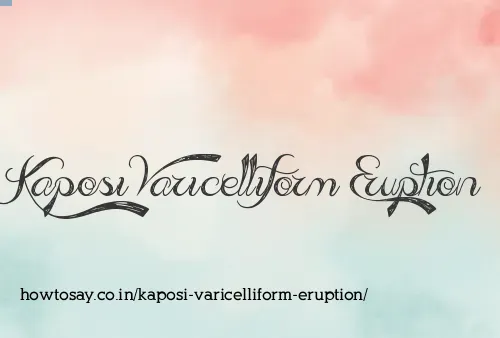 Kaposi Varicelliform Eruption