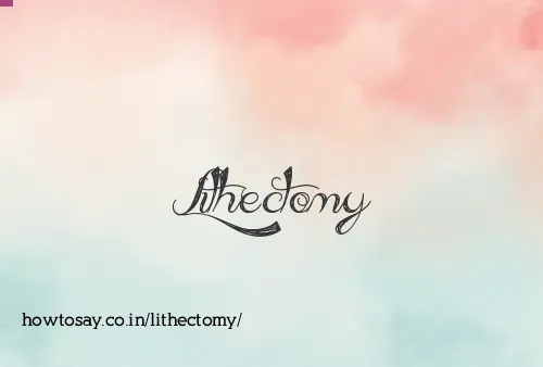 Lithectomy