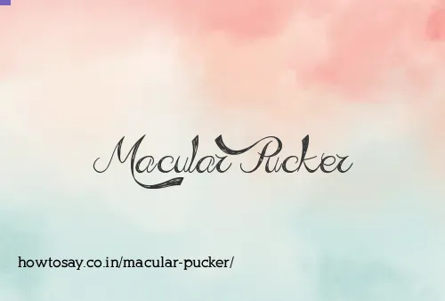 Macular Pucker