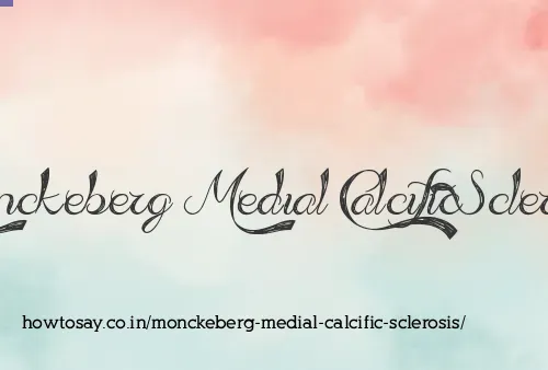 Monckeberg Medial Calcific Sclerosis
