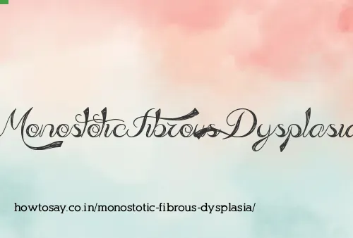 Monostotic Fibrous Dysplasia