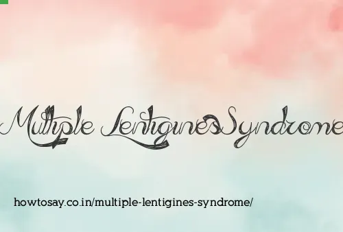 Multiple Lentigines Syndrome