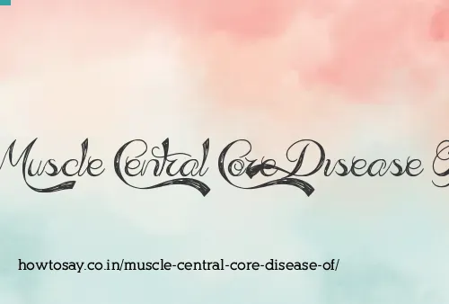 Muscle Central Core Disease Of