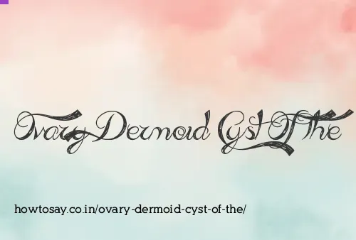 Ovary Dermoid Cyst Of The