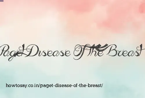 Paget Disease Of The Breast