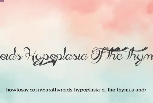 Parathyroids Hypoplasia Of The Thymus And