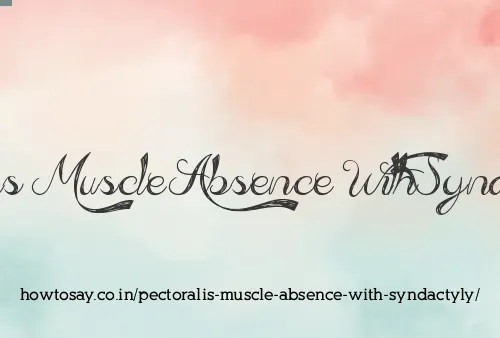 Pectoralis Muscle Absence With Syndactyly