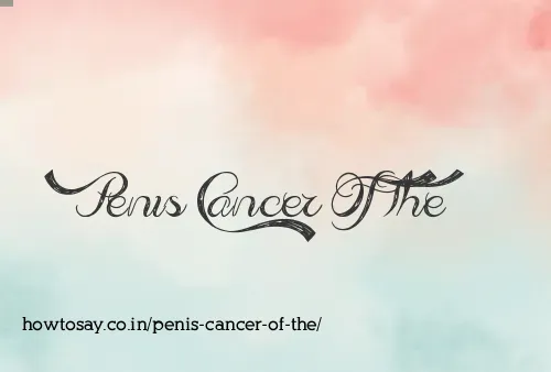 Penis Cancer Of The