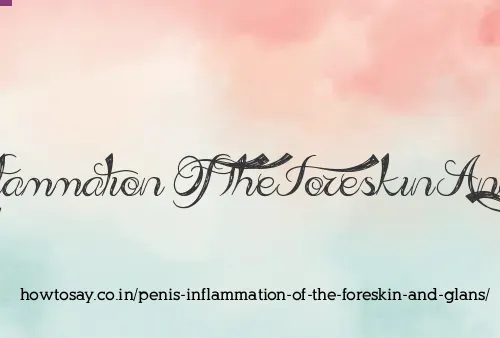 Penis Inflammation Of The Foreskin And Glans