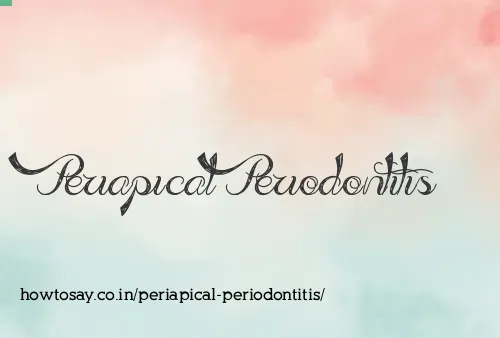 Periapical Periodontitis