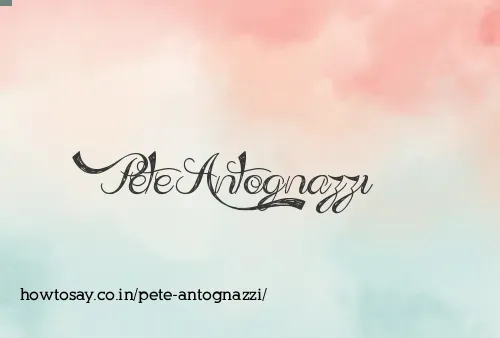 Pete Antognazzi