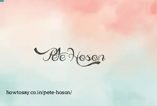 Pete Hoson