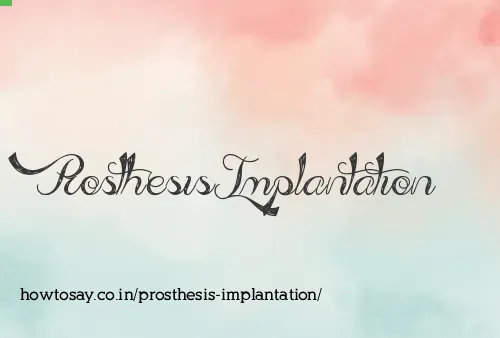 Prosthesis Implantation