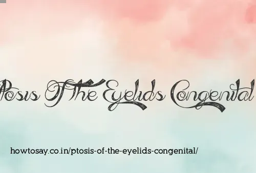Ptosis Of The Eyelids Congenital