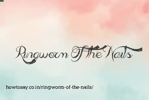 Ringworm Of The Nails