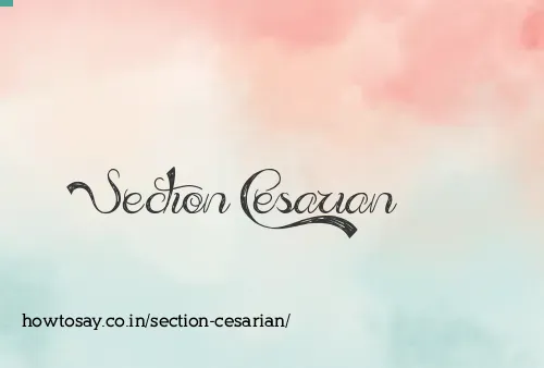 Section Cesarian