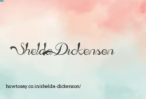 Shelda Dickenson