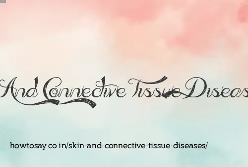 Skin And Connective Tissue Diseases
